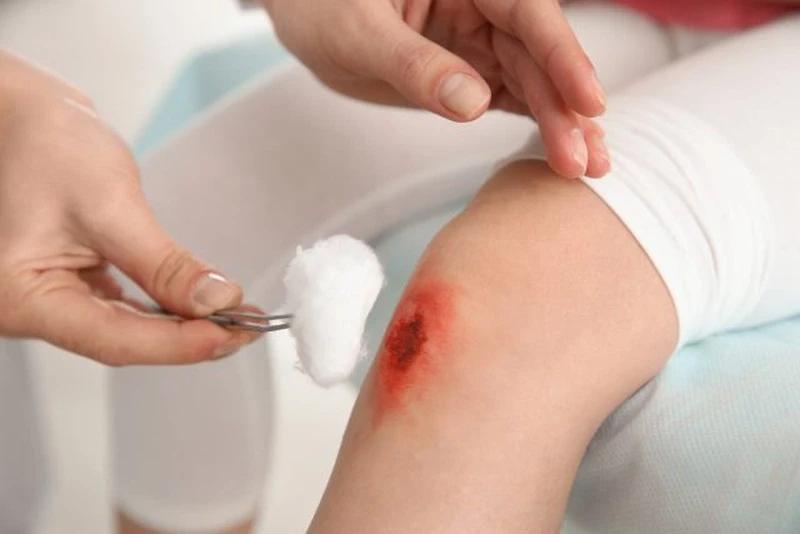 Kẽm giúp kháng viêm hiệu quả